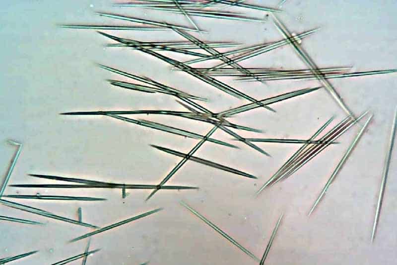 Calcium oxalate crystals